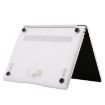Huawei MateBook D 15/MagicBook 15/X15 Transparent Protective Case - 5