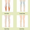 Upgrade Fever Leg Massager Calf Air Wave Varicose Vein Device - 5