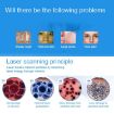 Portable Handheld Picosecond Laser Pen for Tattoo Mole Freckle Removal - 7