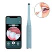 Wireless HD Oral Endoscope FY-B800 - Visual Observation Instrument (Blue) - 1